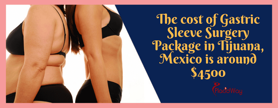 Cost of Gastric Sleeve Surgery in Tijuana Mexico